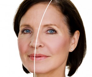 Blepharoplasty Pasadena, TX